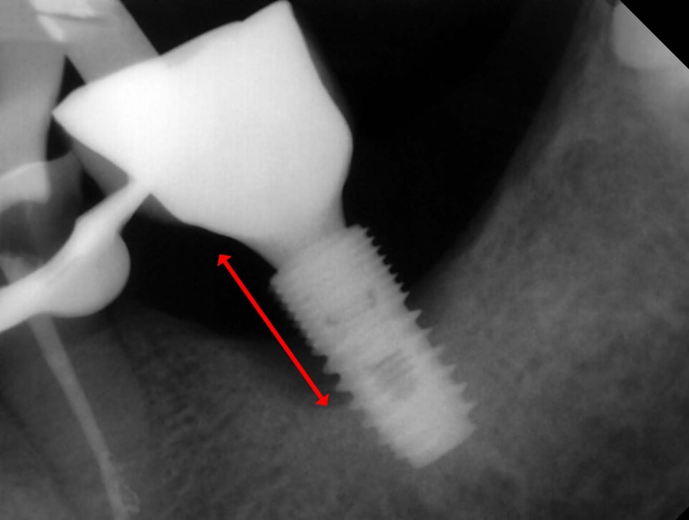 Treatment case image 2