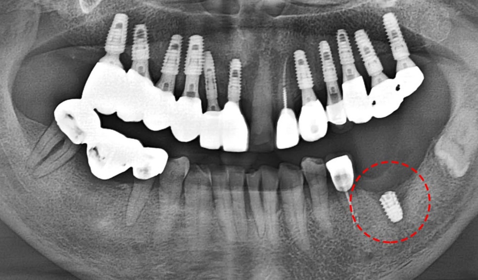 Treatment case image 3