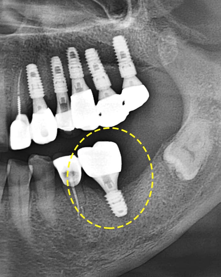 Treatment case image 7