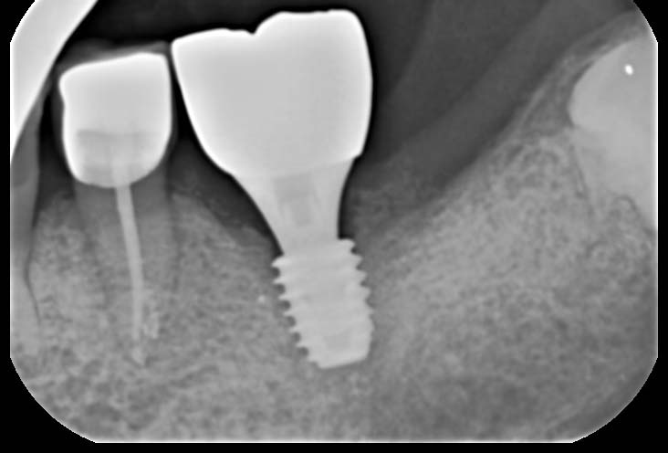 Treatment case image 9