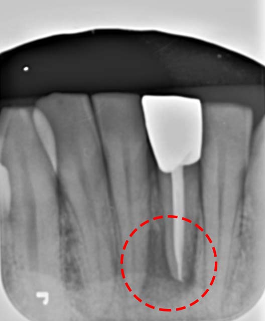 Treatment case image 1