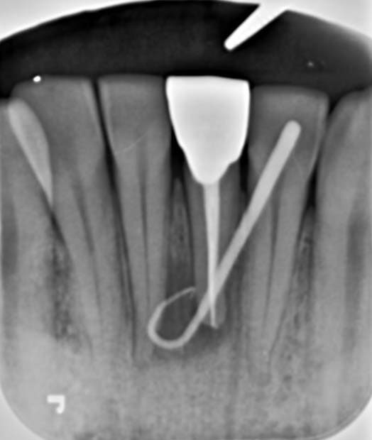 Treatment case image 3