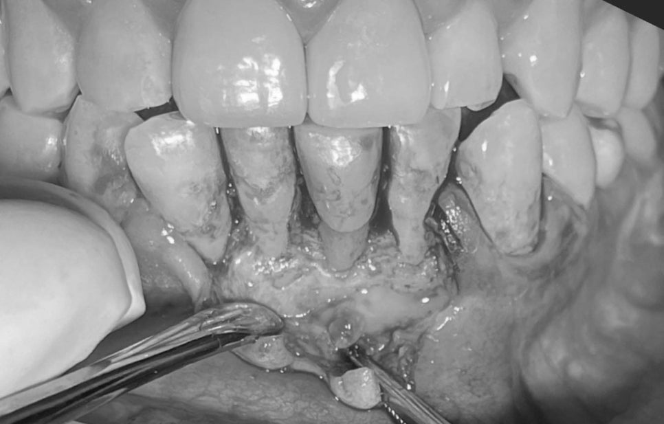 Treatment case image 4