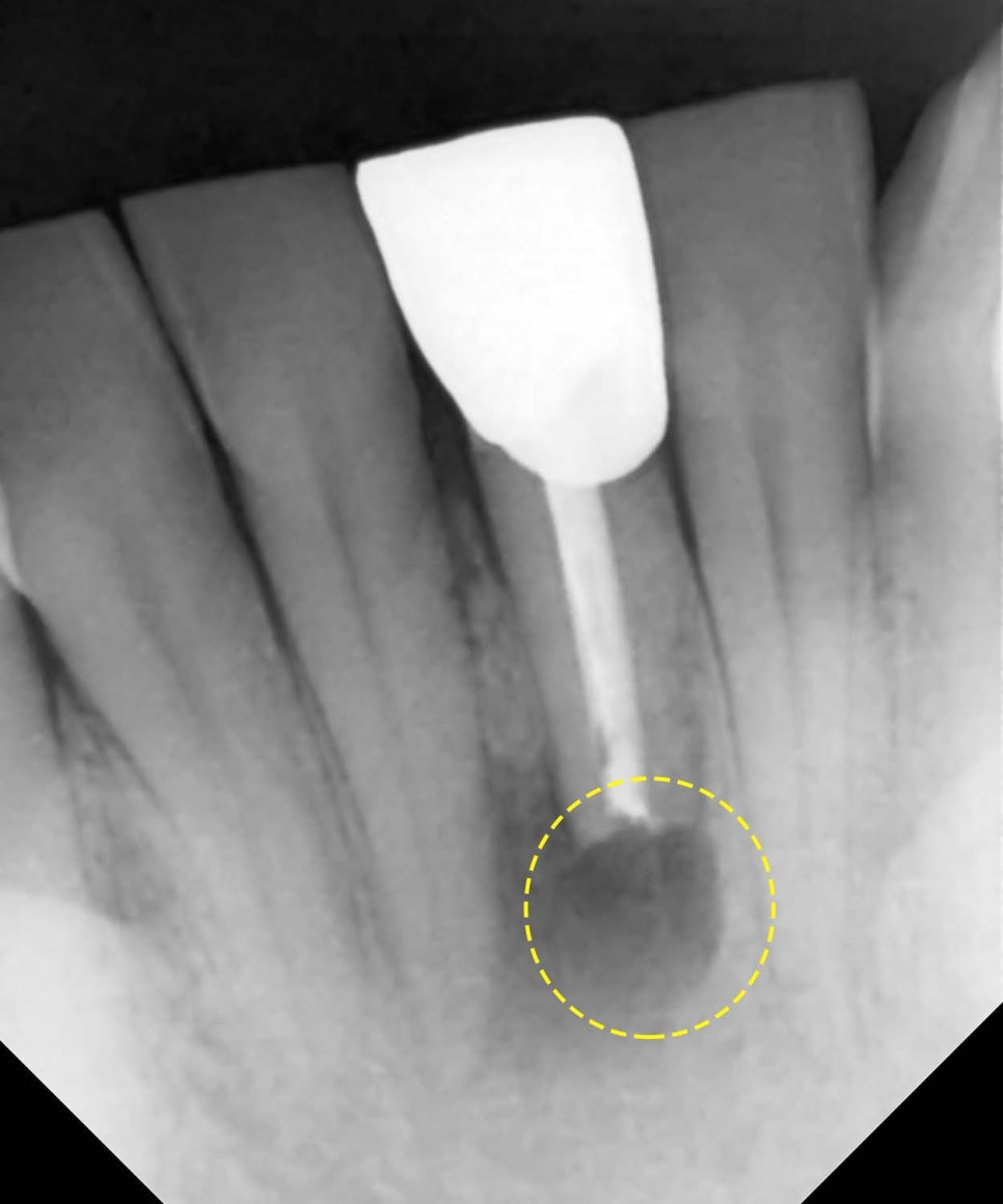 Treatment case image 5