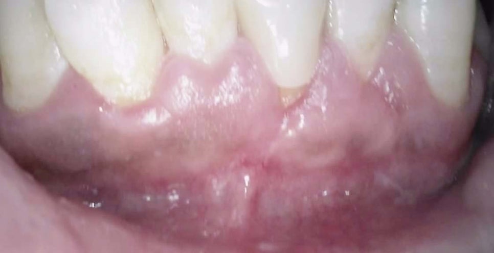 Treatment case image 6