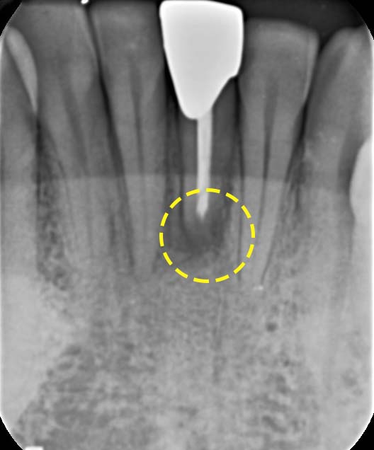 Treatment case image 7