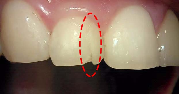 Treatment case image 1