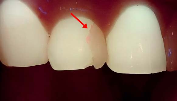 Treatment case image 2