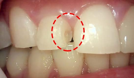 Treatment case image 3