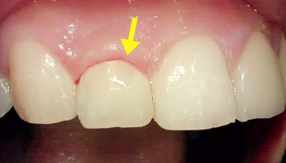 Treatment case image 4