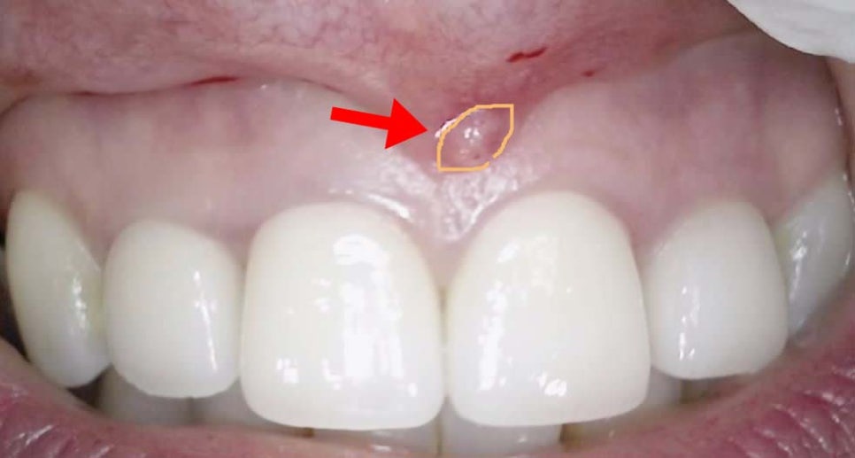 Treatment case image 1