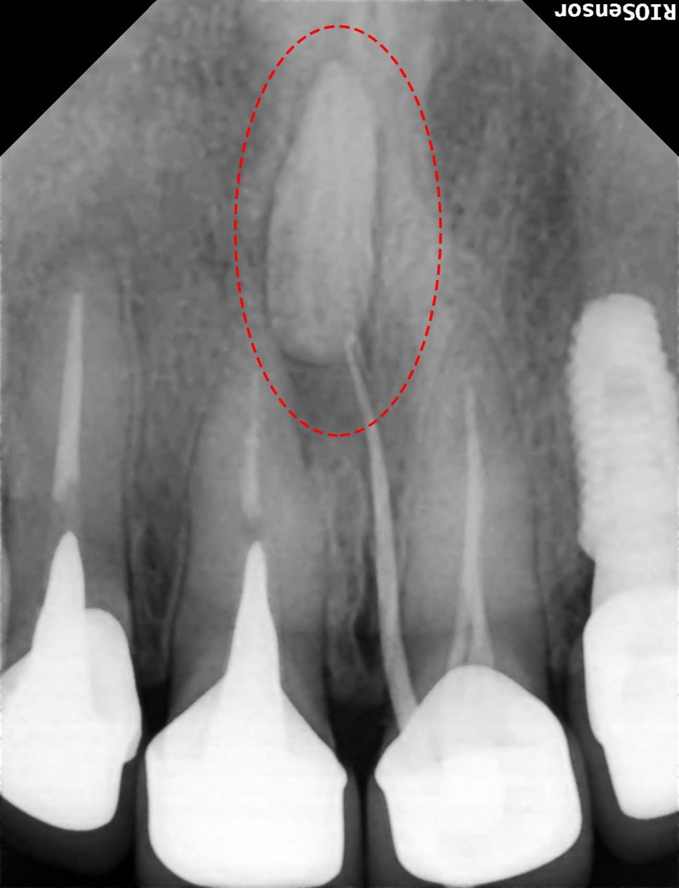 Treatment case image 2
