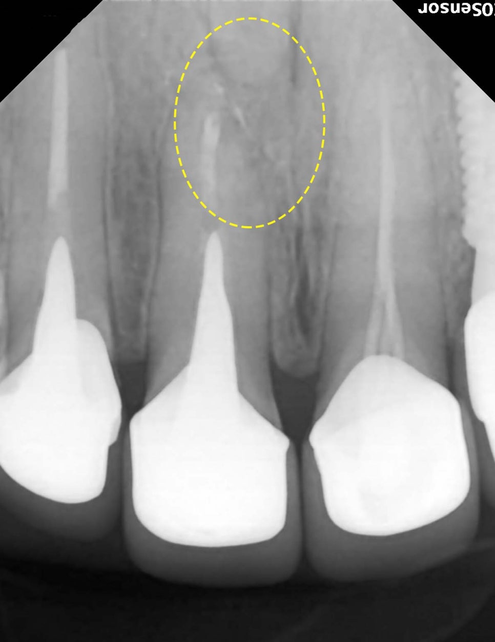 Treatment case image 4