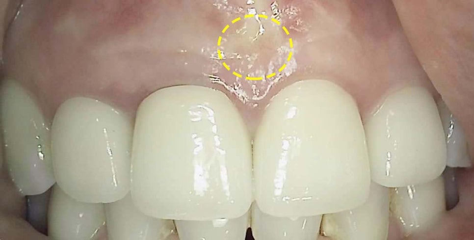 Treatment case image 5