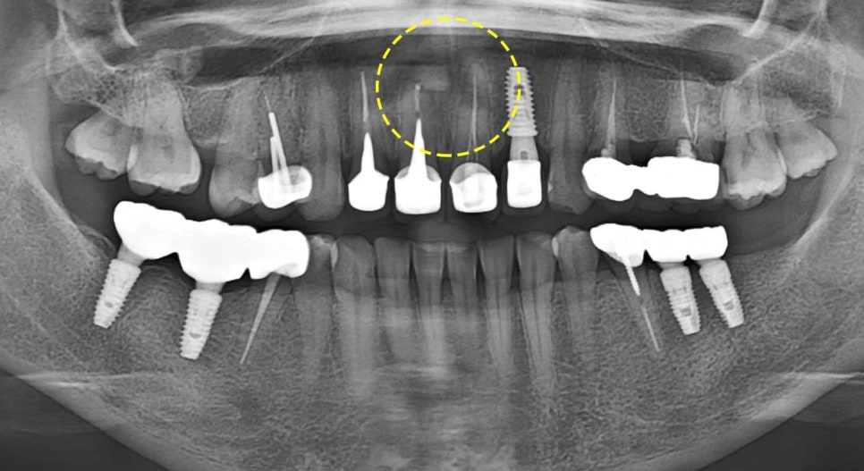 Treatment case image 6