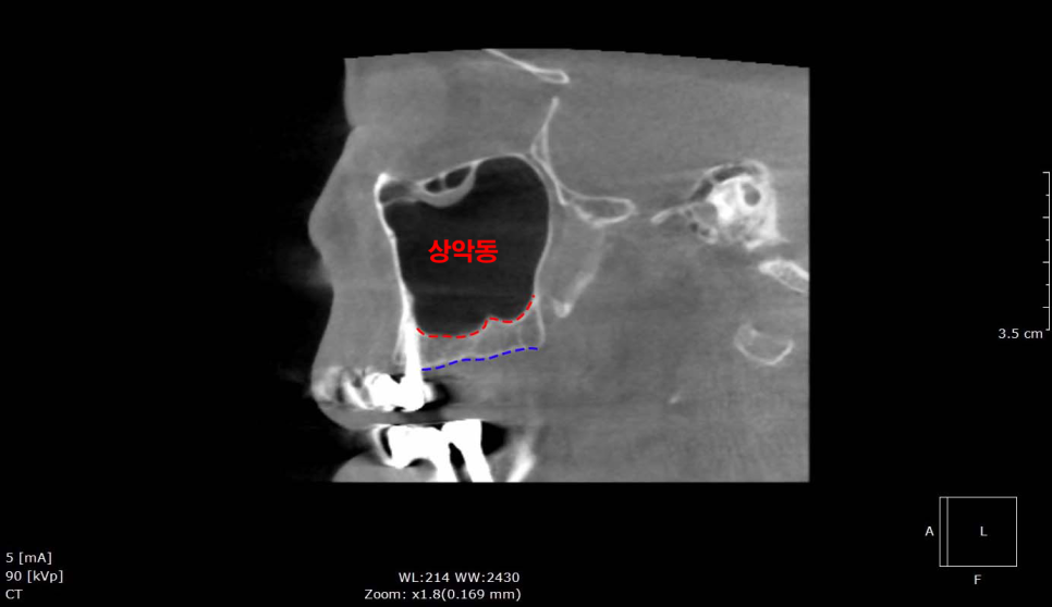 Treatment case image 1
