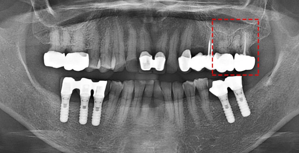 Treatment case image 2