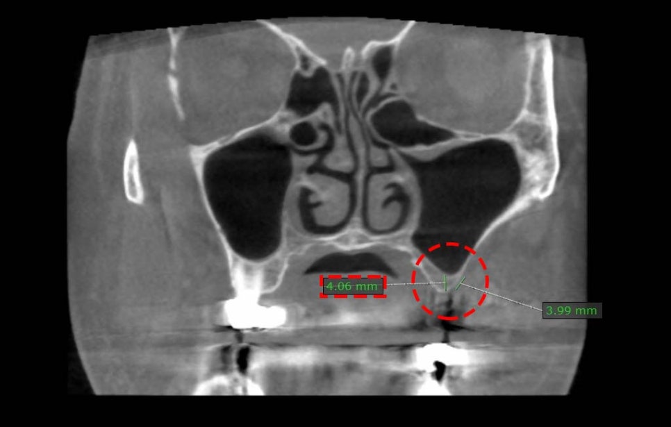 Treatment case image 3