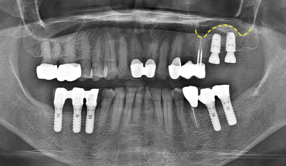 Treatment case image 7