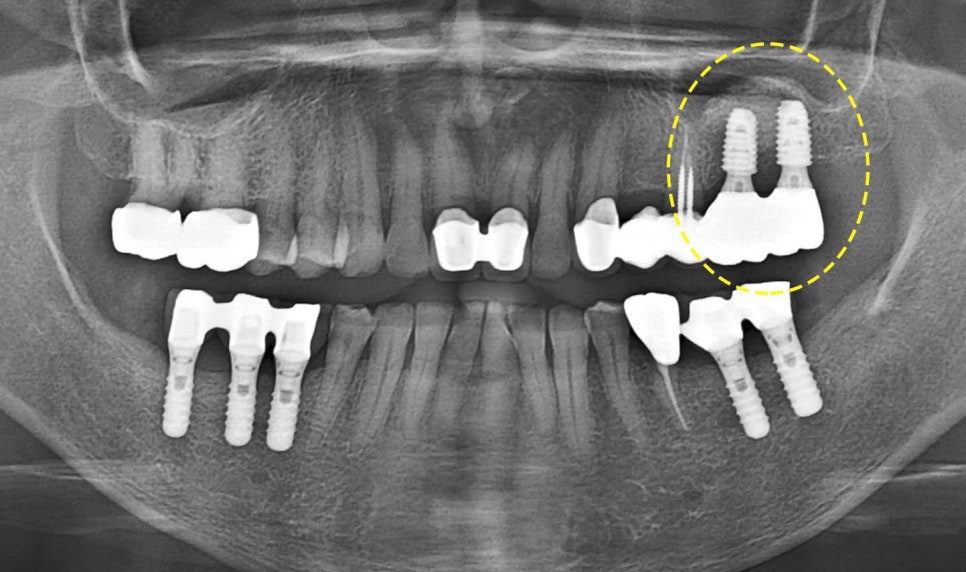 Treatment case image 8
