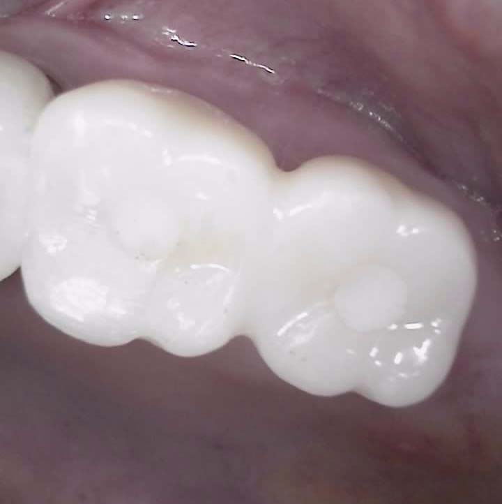 Treatment case image 9