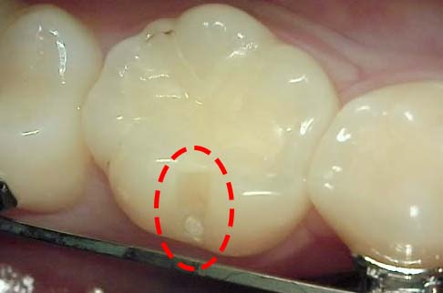 Treatment case image 1