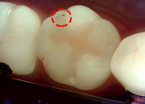 Treatment case image 2