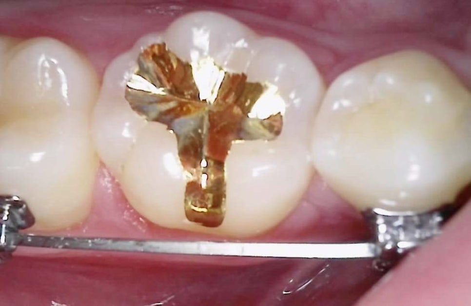 Treatment case image 5