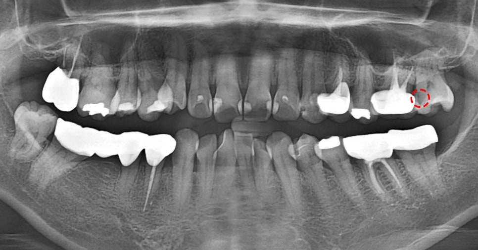 Treatment case image 1