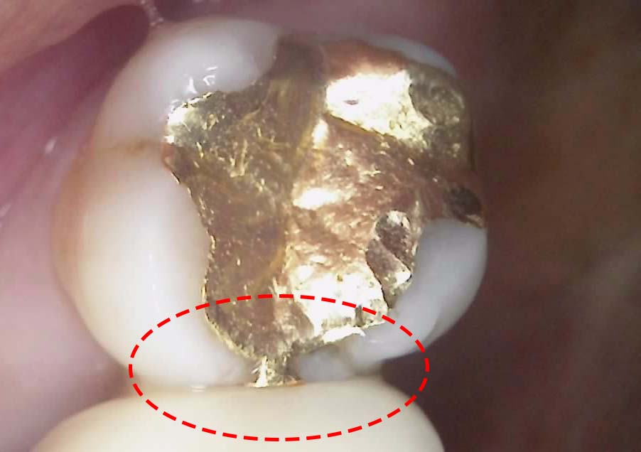 Treatment case image 2