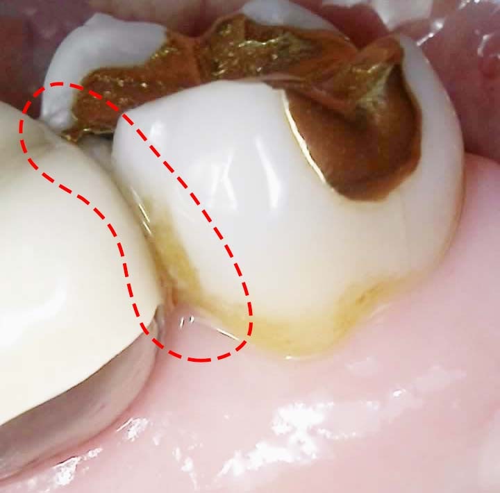 Treatment case image 3