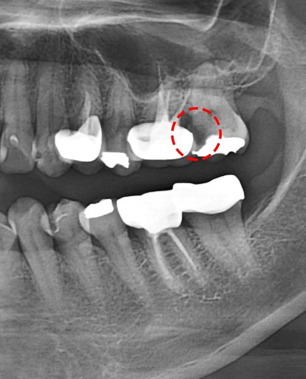 Treatment case image 4