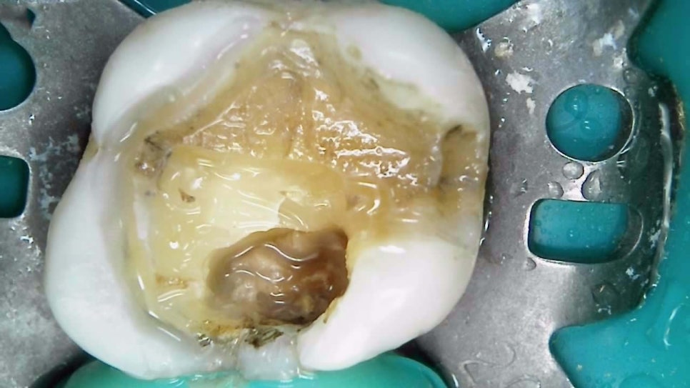 Treatment case image 8