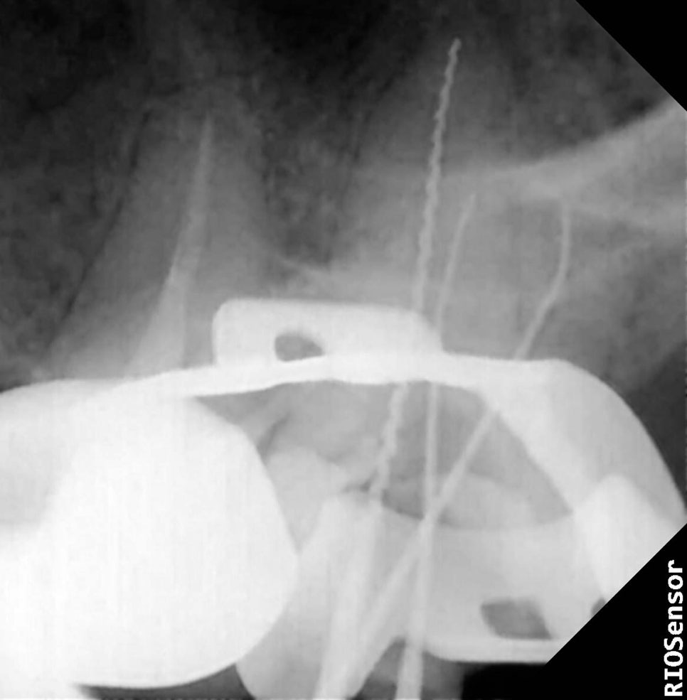 Treatment case image 9