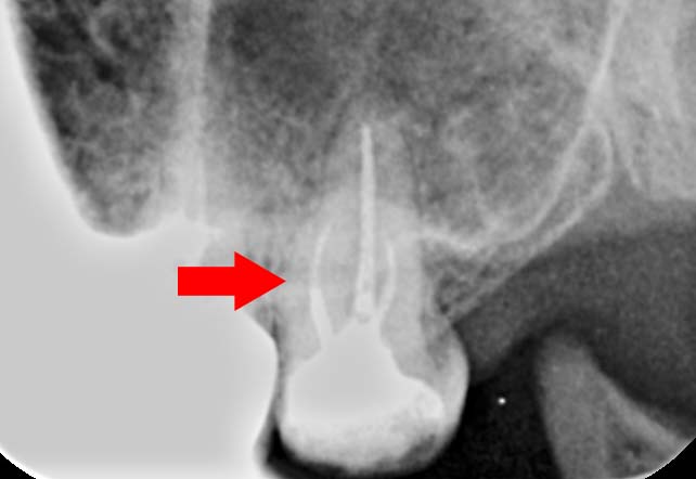 Treatment case image 10