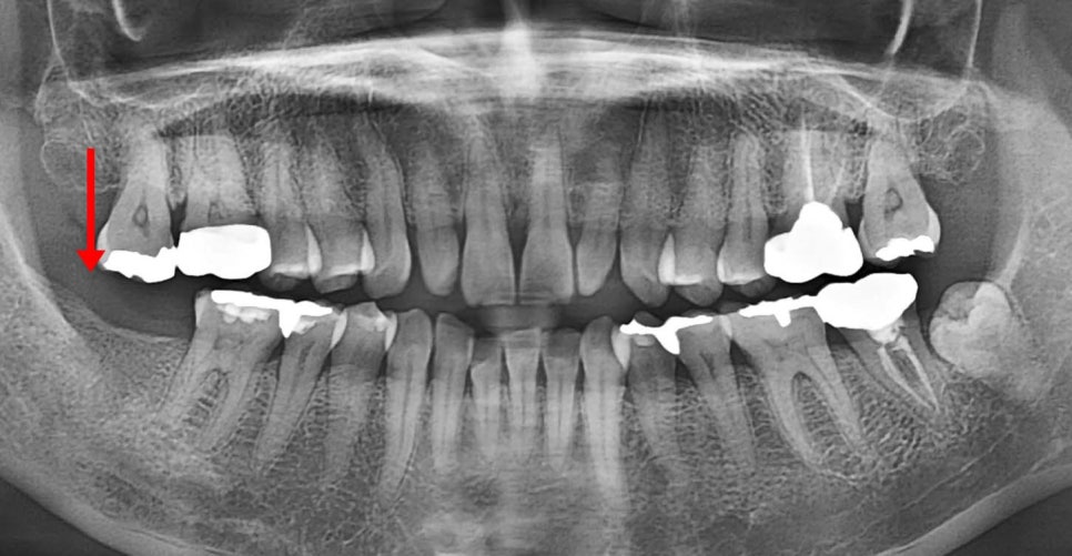 Treatment case image 1
