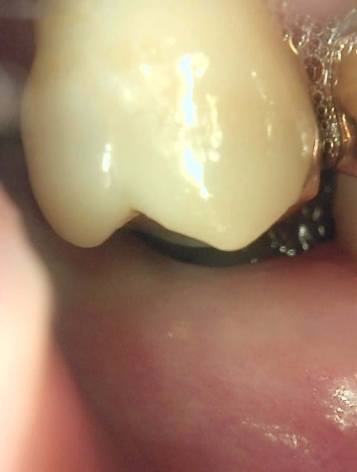 Treatment case image 3