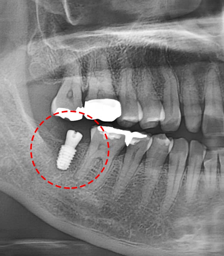 Treatment case image 4