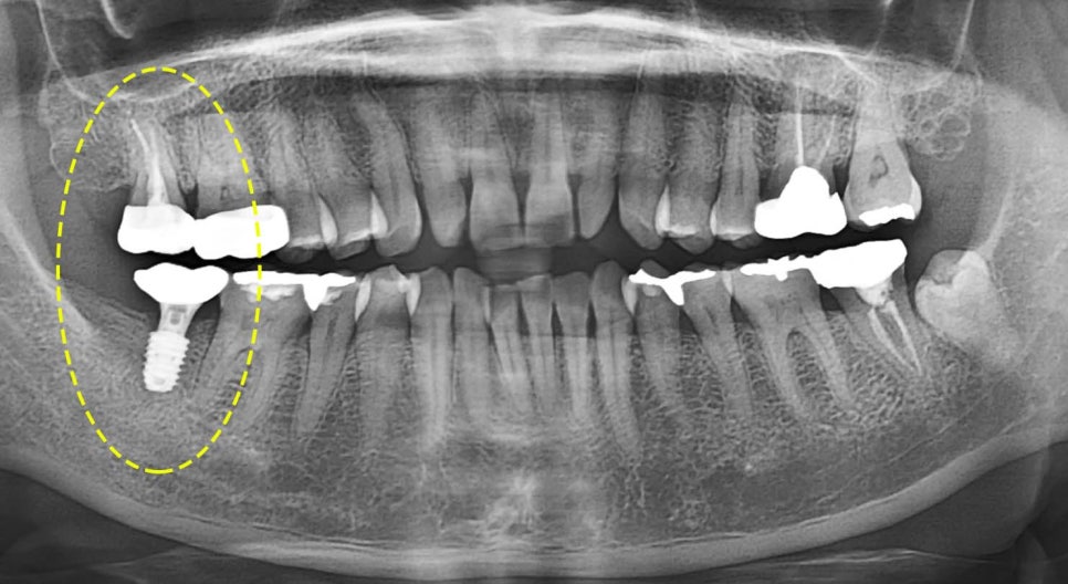 Treatment case image 7