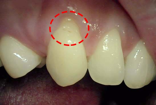 Treatment case image 1
