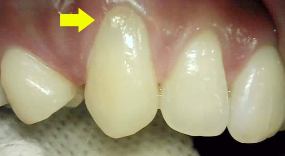 Treatment case image 3