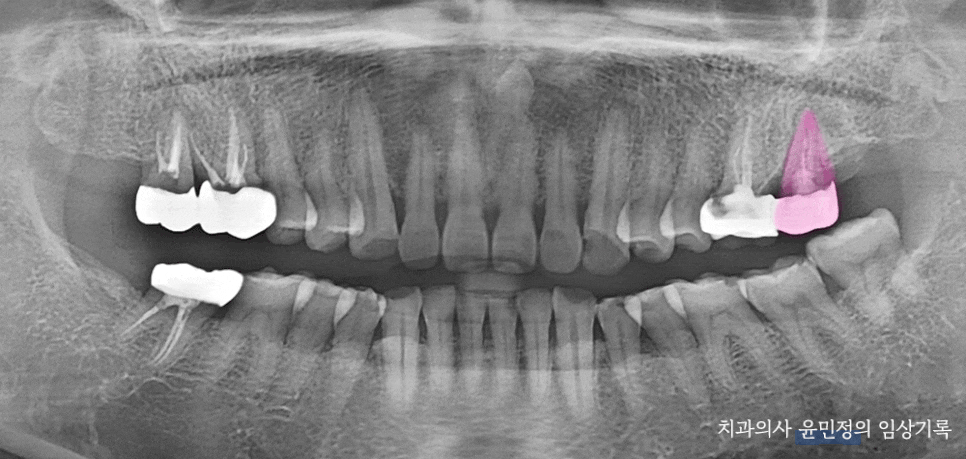 Treatment case image 1
