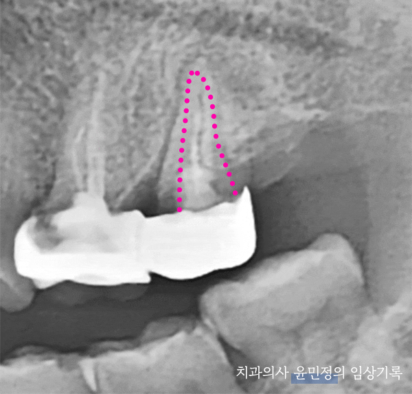 Treatment case image 2