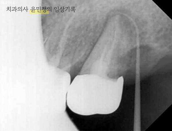 Treatment case image 3