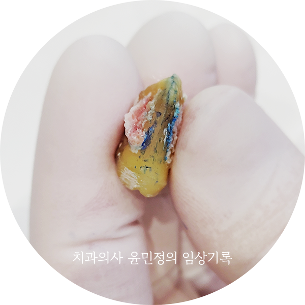 Treatment case image 7