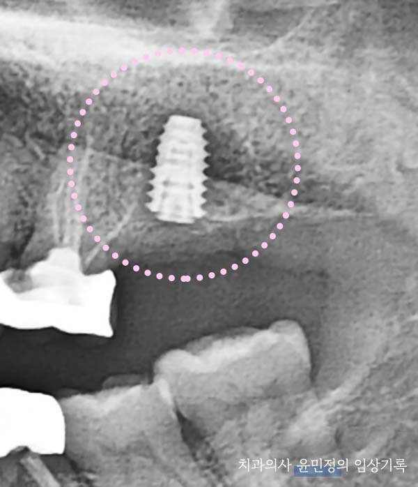 Treatment case image 8