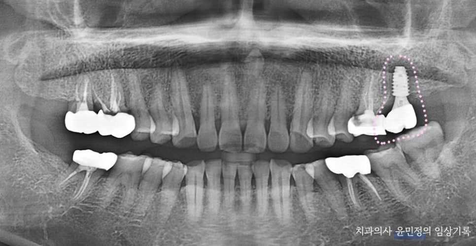 Treatment case image 10