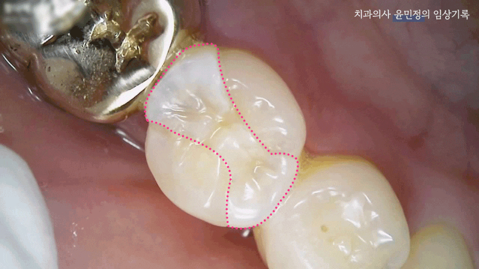 Treatment case image 1