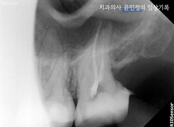 Treatment case image 1