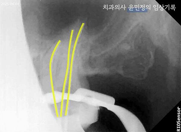 Treatment case image 2